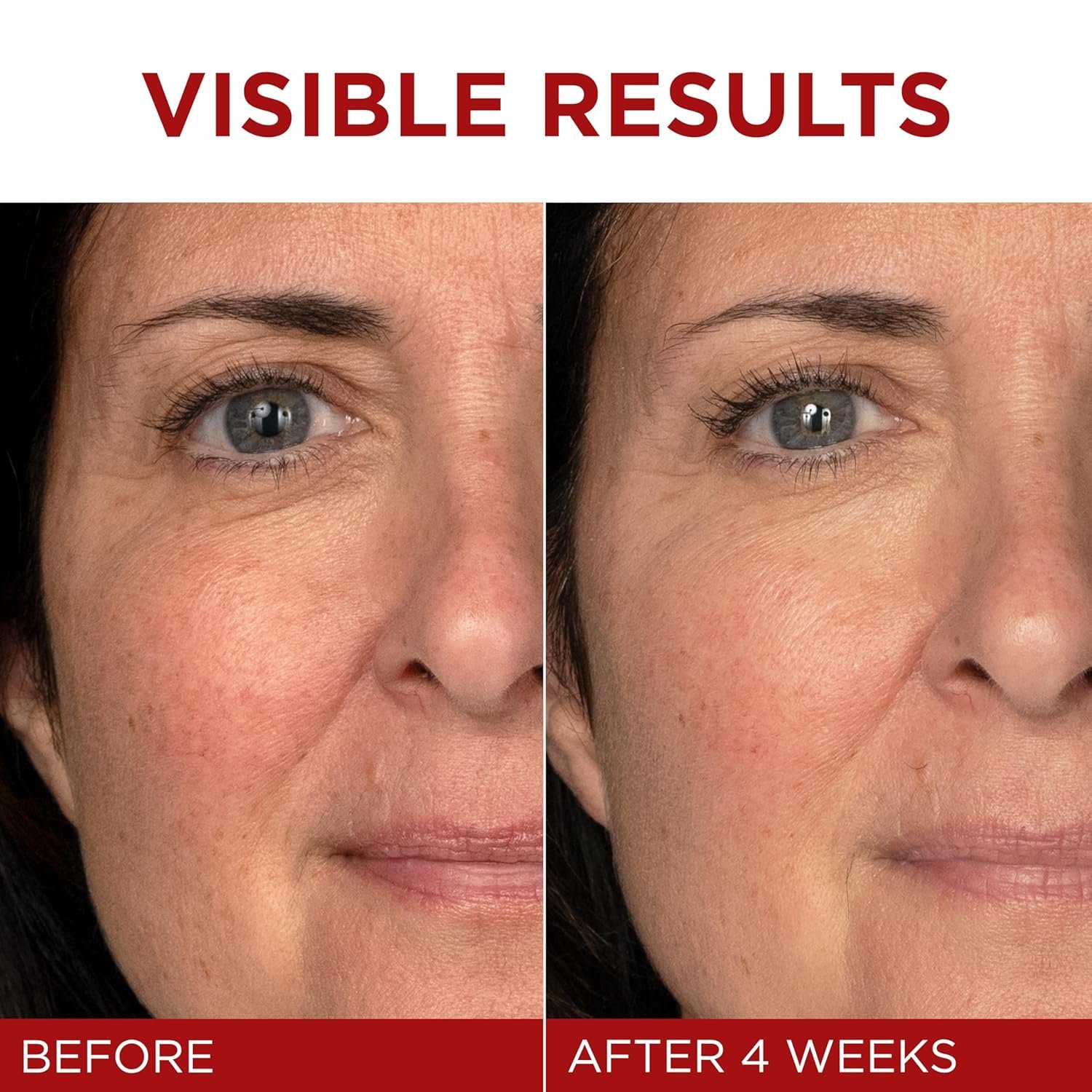 Anti-Aging Moisturizer