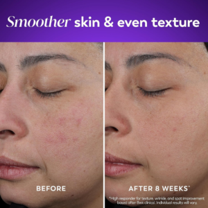 olay retinol 24 night cream – anti aging moisturizer cream with triple collagen peptide, niacinamide & hydration boost | smooth wrinkles, brighten skin overnight