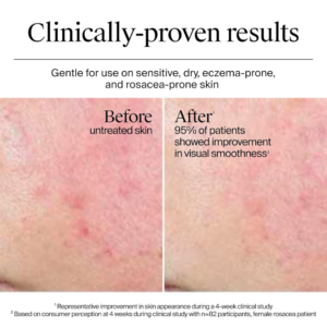 neutrogena hydro boost water cream – 72 hour hydration water cream & hydrating gel cleanser skincare